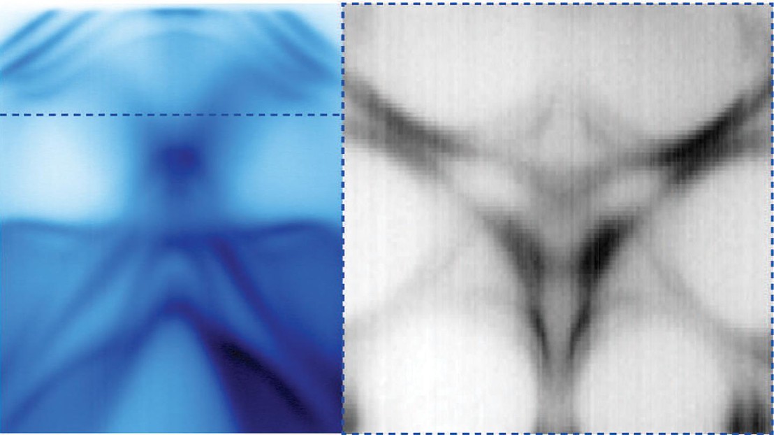 Observation of triple-point Fermions